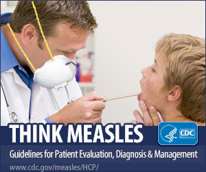 Think Measles - Guidelines for Patient Evaluation, Diagnosis & Management - www.cdc.gov/measles/HCP/
